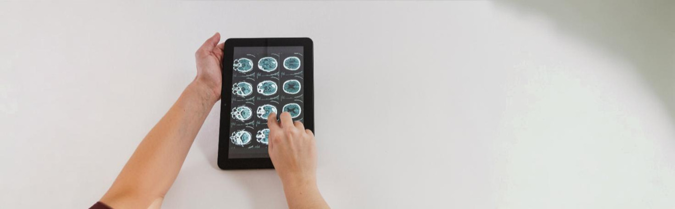 Patient undergoing a brain MRI scan in a medical imaging facility for neurological diagnosis.