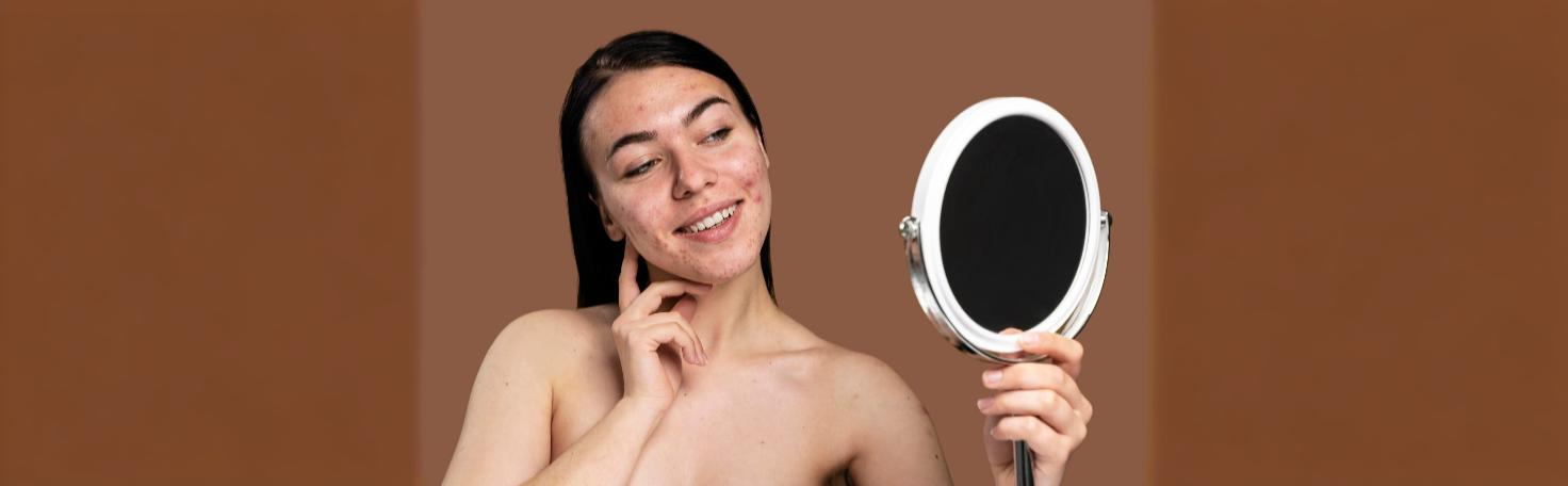Close-up of a patient undergoing carbon dioxide laser treatment for acne scar removal, highlighting skin resurfacing benefits.