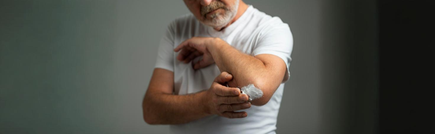 A dermatologist performing laser therapy on a patient’s psoriasis-affected skin for symptom relief.