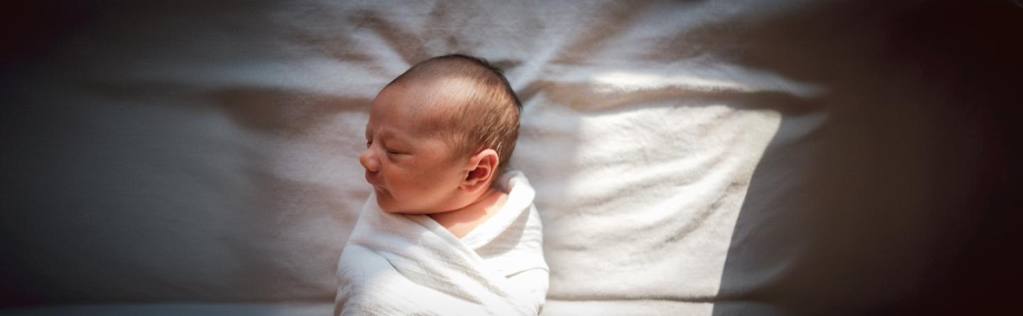 Surgeons performing the Norwood procedure on a newborn with HLHS, a severe congenital heart defect requiring staged surgeries.